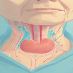 Silent thyroiditis
