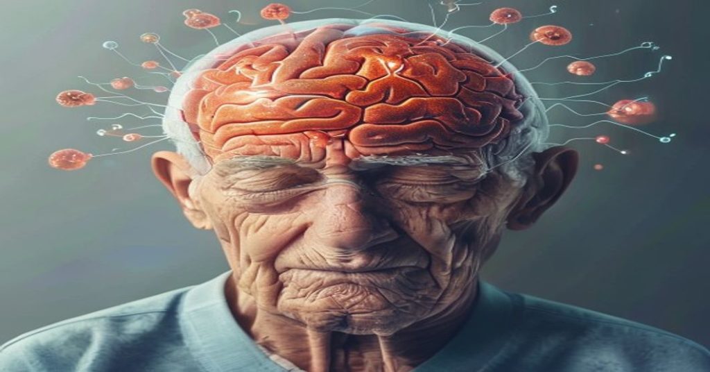 Subarachnoid Hemorrhage in Seniors: Signs, Treatment, and Prevention