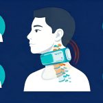 Neck Pain in Seniors: Causes, Relief and Exercise Tips