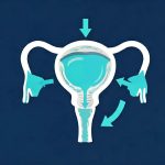 Artificial Urinary Sphincter: A Caregiver Guide for Seniors