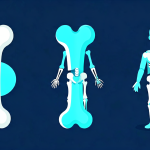 Osteoporosis Prevention - Bone health