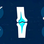 Arthritis Exercise - Joint health and mobility