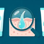 Acne in Seniors: Causes, Treatment and Skin Care Tips