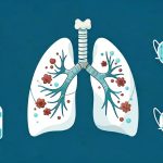 Pneumonia in Seniors: Causes, Prevention and Treatment