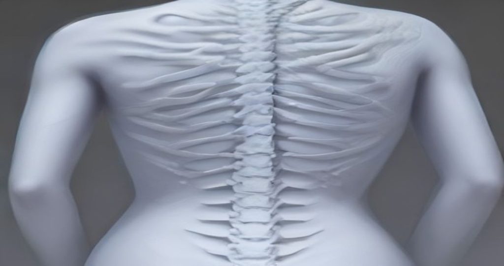 Compression Fractures of the Back in Seniors